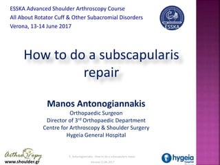 www.shoulder.gr
E. Antonogiannakis How to do a subscapularis repair
Verona 13.06.2017
How to do a subscapularis
repair
Manos Antonogiannakis
Orthopaedic Surgeon
Director of 3rd Orthopaedic Department
Centre for Arthroscopy & Shoulder Surgery
Hygeia General Hospital
ESSKA Advanced Shoulder Arthroscopy Course
All About Rotator Cuff & Other Subacromial Disorders
Verona, 13-14 June 2017 .
 