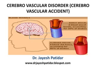 CEREBRO VASCULAR DISORDER (CEREBRO
VASCULAR ACCIDENT)
Dr. Jayesh Patidar
www.drjayeshpatidar.blospot.com
 