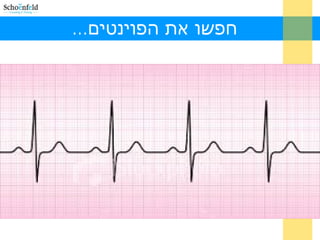 ...‫הפוינטים‬ ‫את‬ ‫חפשו‬
 