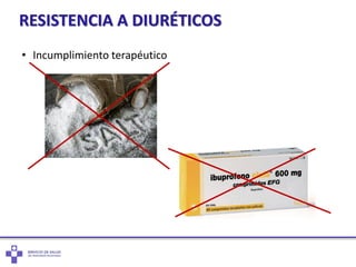 RESISTENCIA A DIURÉTICOS
• Incumplimiento terapéutico
 