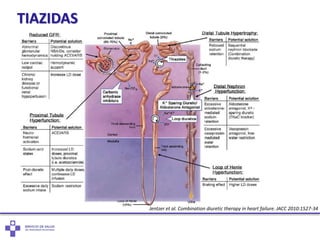 TIAZIDAS
Jentzer et al. Combination diuretic therapy in heart failure. JACC 2010:1527-34
 