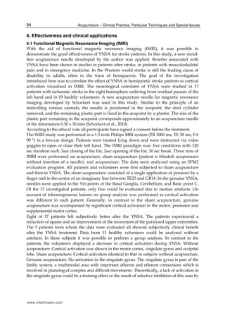 Yamamoto new scalp acupuncture | PDF