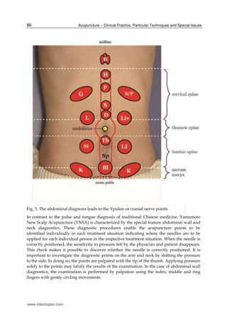 Yamamoto new scalp acupuncture | PDF