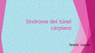 Síndrome del túnel
carpiano
Yaneth cuevas
 