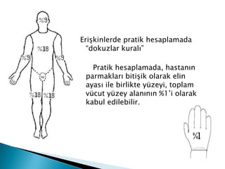 Erişkinlerde pratik hesaplamada
“dokuzlar kuralı”
Pratik hesaplamada, hastanın
parmakları bitişik olarak elin
ayası ile birlikte yüzeyi, toplam
vücut yüzey alanının %1’i olarak
kabul edilebilir.
 