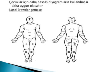 Çocuklar için daha hassas diyagramların kullanılması
daha uygun olacaktır
Lund Browder şeması:
 