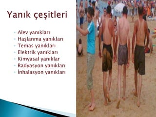 ◦ Alev yanıkları
◦ Haşlanma yanıkları
◦ Temas yanıkları
◦ Elektrik yanıkları
◦ Kimyasal yanıklar
◦ Radyasyon yanıkları
◦ İnhalasyon yanıkları
 