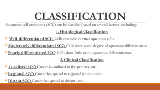 Squamous cell Carcinoma by Dr. Muhammad Yaseen | PPTX