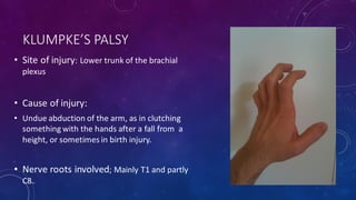 Fall Plexus Event Brachial plexus .pdf