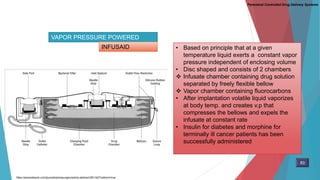 VAPOR PRESSURE POWERED
INFUSAID • Based on principle that at a given
temperature liquid exerts a constant vapor
pressure independent of enclosing volume
• Disc shaped and consists of 2 chambers
 Infusate chamber containing drug solution
separated by freely flexible bellow
 Vapor chamber containing fluorocarbons
• After implantation volatile liquid vaporizes
at body temp. and creates v.p that
compresses the bellows and expels the
infusate at constant rate
• Insulin for diabetes and morphine for
terminally ill cancer patients has been
successfully administered
Parenteral Controlled Drug Delivery Systems
https://jamanetwork.com/journals/jamasurgery/article-abstract/391162?redirect=true
83
 