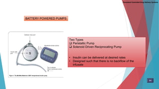 BATTERY POWERED PUMPS
Two Types
 Peristaltic Pump
 Solenoid Driven Reciprocating Pump
• Insulin can be delivered at desired rates
• Designed such that there is no backflow of the
infusate
Parenteral Controlled Drug Delivery Systems
84
 