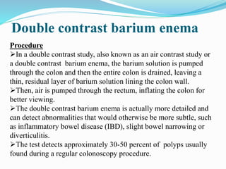 Double contrast barium enema
Procedure
In a double contrast study, also known as an air contrast study or
a double contrast barium enema, the barium solution is pumped
through the colon and then the entire colon is drained, leaving a
thin, residual layer of barium solution lining the colon wall.
Then, air is pumped through the rectum, inflating the colon for
better viewing.
The double contrast barium enema is actually more detailed and
can detect abnormalities that would otherwise be more subtle, such
as inflammatory bowel disease (IBD), slight bowel narrowing or
diverticulitis.
The test detects approximately 30-50 percent of polyps usually
found during a regular colonoscopy procedure.
 