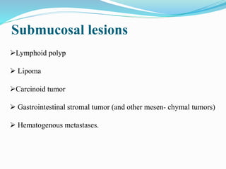 Submucosal lesions
Lymphoid polyp
 Lipoma
Carcinoid tumor
 Gastrointestinal stromal tumor (and other mesen- chymal tumors)
 Hematogenous metastases.
 
