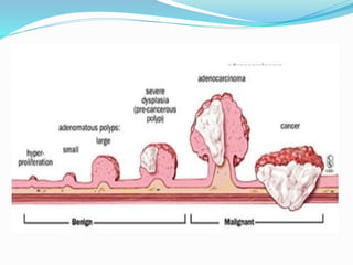 Imaging of Large Bowel Polyp | PPT