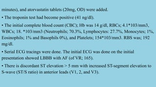 Vr Rbcs Yasser's Criterion of Inferior ST-Segment Discrepancy Deviations in AF ...