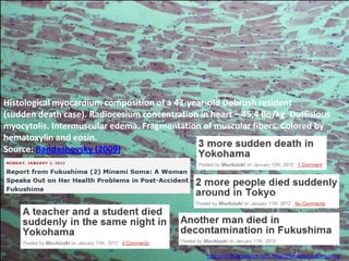 Histological myocardium composition of a 43-year-old Dobrush resident
(sudden death case). Radiocesium concentration in heart – 45,4 Bq/kg. Duffisious
myocytolis. Intermuscular edema. Fragmentation of muscular fibers. Colored by
hematoxylin and eosin.
Source: Bandashevsky (2009)




                                                 http://ex-skf.blogspot.com, http://fukushima-diary.com/
 