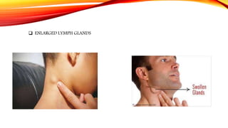  ENLARGED LYMPH GLANDS
 
