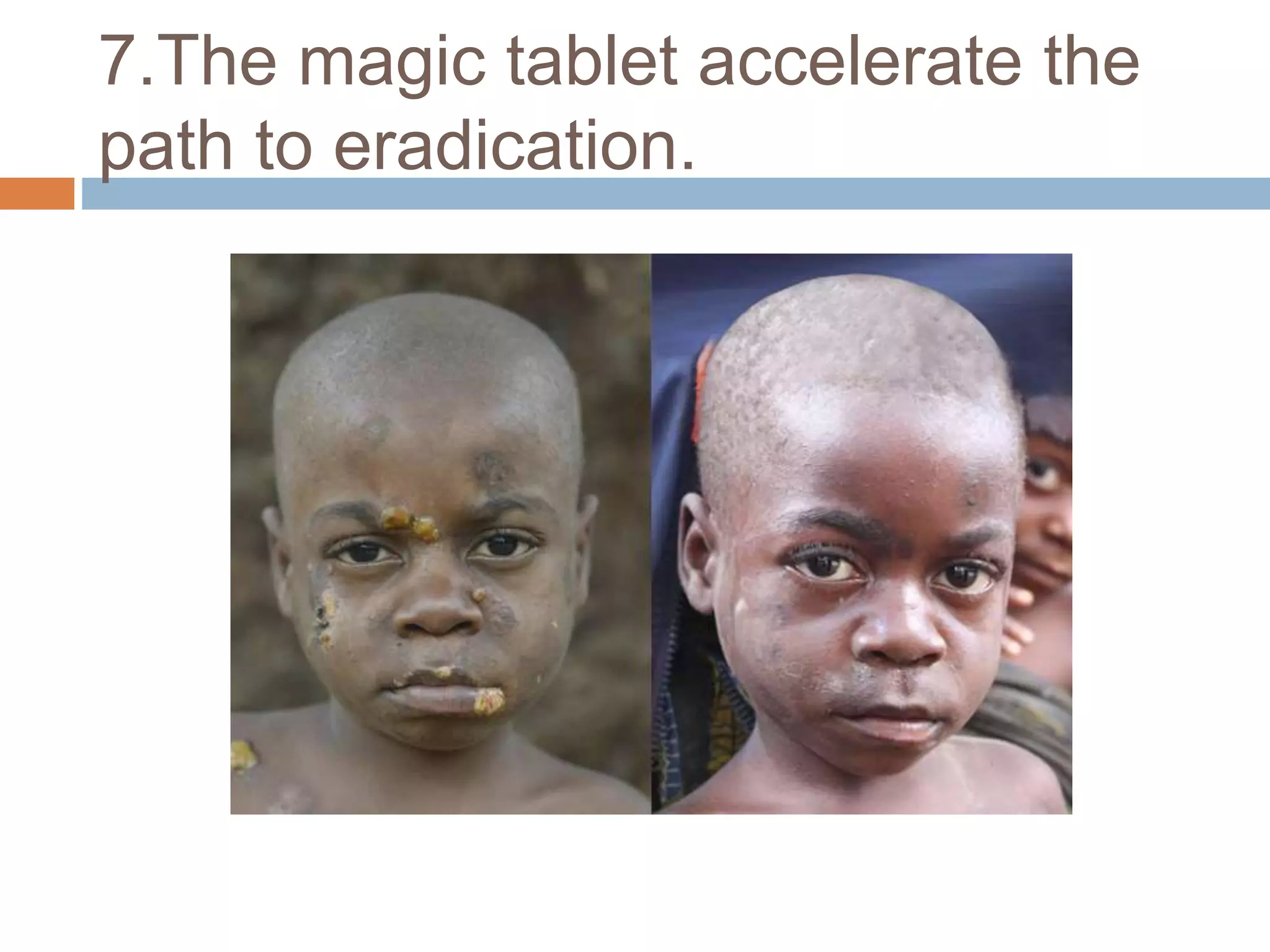 7.The magic tablet accelerate the
path to eradication.
 