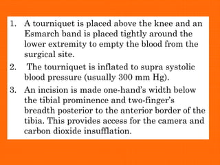 1. A tourniquet is placed above the knee and an
Esmarch band is placed tightly around the
lower extremity to empty the blood from the
surgical site.
2. The tourniquet is inflated to supra systolic
blood pressure (usually 300 mm Hg).
3. An incision is made one-hand’s width below
the tibial prominence and two-finger’s
breadth posterior to the anterior border of the
tibia. This provides access for the camera and
carbon dioxide insufflation.
 