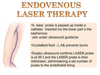 •A laser probe is passed up inside a
catheter inserted ino the lower part o the
saphenous
vein under ultrasound guidance
•Crystalloid fluid - L.A& prevents burns
•Duplex ultrasound confirms LASER probe
is at SFJ and the LASER probe is then
withdrawn, administering a set number of
joules to the endothelial lining
 