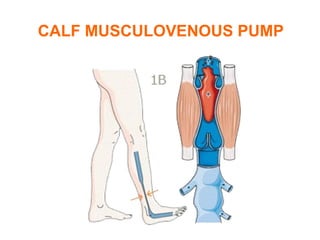 CALF MUSCULOVENOUS PUMP
 