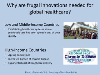 Why are frugal innovations needed for
global healthcare?
High-Income Countries
• Ageing populations
• Increased burden of chronic disease
• Exponential cost of healthcare delivery
Low and Middle-Income Countries
• Establishing healthcare systems where
previously care has been sporadic and of poor
quality
Photo of Malawi Clinic, Courtesy of Matthew Prime
 