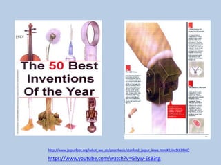 http://www.jaipurfoot.org/what_we_do/prosthesis/stanford_jaipur_knee.html#.UihcStKPPHQ
https://www.youtube.com/watch?v=GTyw-EsB3tg
 