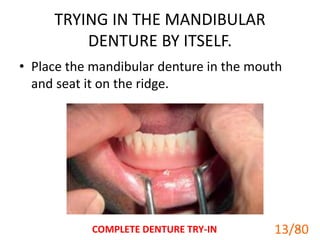TRYING IN THE MANDIBULAR
DENTURE BY ITSELF.
• Place the mandibular denture in the mouth
and seat it on the ridge.
COMPLETE DENTURE TRY-IN 13
13/80
 