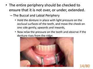 • The entire periphery should be checked to
ensure that it is not over, or under, extended.
– The Buccal and Labial Periphery
• Hold the denture in place with light pressure on the
occlusal surfaces of the teeth, and move the cheek on
one side gently, upwards and inwards,
• Now relax the pressure on the teeth and observe if the
denture rises from the ridge.
COMPLETE DENTURE TRY-IN 14
14/80
 