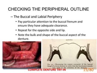 CHECKING THE PERIPHERAL OUTLINE
– The Buccal and Labial Periphery
• Pay particular attention to the buccal frenum and
ensure they have adequate clearance.
• Repeat for the opposite side and lip.
• Note the bulk and shape of the buccal aspect of the
denture.
COMPLETE DENTURE TRY-IN 15
15/80
 