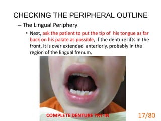 CHECKING THE PERIPHERAL OUTLINE
– The Lingual Periphery
• Next, ask the patient to put the tip of his tongue as far
back on his palate as possible, if the denture lifts in the
front, it is over extended anteriorly, probably in the
region of the lingual frenum.
COMPLETE DENTURE TRY-IN 17
17/80
 