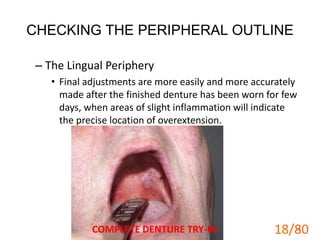 CHECKING THE PERIPHERAL OUTLINE
– The Lingual Periphery
• Final adjustments are more easily and more accurately
made after the finished denture has been worn for few
days, when areas of slight inflammation will indicate
the precise location of overextension.
COMPLETE DENTURE TRY-IN 18
18/80
 
