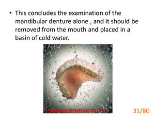 • This concludes the examination of the
mandibular denture alone , and it should be
removed from the mouth and placed in a
basin of cold water.
COMPLETE DENTURE TRY-IN 31
31/80
 