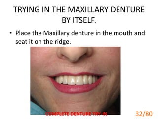 TRYING IN THE MAXILLARY DENTURE
BY ITSELF.
• Place the Maxillary denture in the mouth and
seat it on the ridge.
COMPLETE DENTURE TRY-IN 32
32/80
 