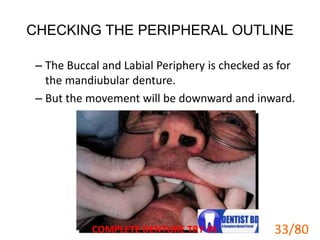 CHECKING THE PERIPHERAL OUTLINE
– The Buccal and Labial Periphery is checked as for
the mandiubular denture.
– But the movement will be downward and inward.
COMPLETE DENTURE TRY-IN 33
33/80
 