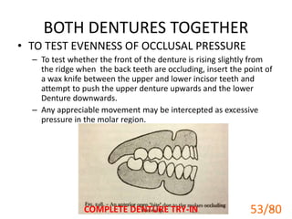 BOTH DENTURES TOGETHER
• TO TEST EVENNESS OF OCCLUSAL PRESSURE
– To test whether the front of the denture is rising slightly from
the ridge when the back teeth are occluding, insert the point of
a wax knife between the upper and lower incisor teeth and
attempt to push the upper denture upwards and the lower
Denture downwards.
– Any appreciable movement may be intercepted as excessive
pressure in the molar region.
COMPLETE DENTURE TRY-IN 53
53/80
 