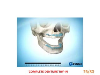 76/80COMPLETE DENTURE TRY-IN
 