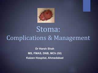 Stoma:
Complications & Management
Dr Harsh Shah
MS, FMAS, DNB, MCh (GI)
Kaizen Hospital, Ahmedabad
 
