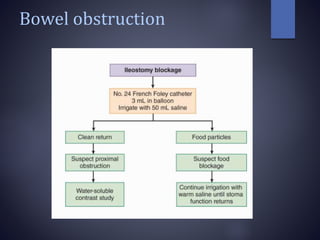 Bowel obstruction
 