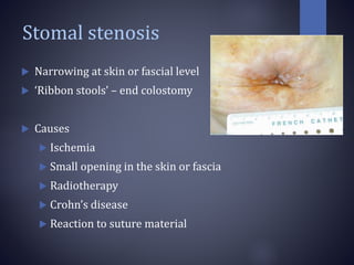 Stomal stenosis
 Narrowing at skin or fascial level
 ‘Ribbon stools’ – end colostomy
 Causes
 Ischemia
 Small opening in the skin or fascia
 Radiotherapy
 Crohn’s disease
 Reaction to suture material
 