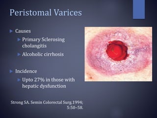 Peristomal Varices
 Causes
 Primary Sclerosing
cholangitis
 Alcoholic cirrhosis
 Incidence
 Upto 27% in those with
hepatic dysfunction
Strong SA. Semin Colorectal Surg.1994;
5:50–58.
 