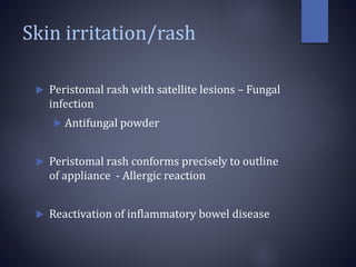Skin irritation/rash
 Peristomal rash with satellite lesions – Fungal
infection
 Antifungal powder
 Peristomal rash conforms precisely to outline
of appliance - Allergic reaction
 Reactivation of inflammatory bowel disease
 