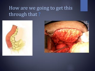 How are we going to get this
through that ?
 