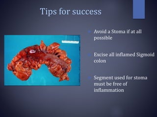 Tips for success
 Avoid a Stoma if at all
possible
 Excise all inflamed Sigmoid
colon
 Segment used for stoma
must be free of
inflammation
 