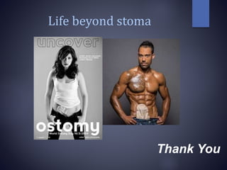 Life beyond stoma
Thank You
 