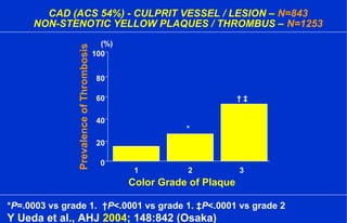 CAD (ACS 54%) - CULPRIT VESSEL / LESION – N=843
NON-STENOTIC YELLOW PLAQUES / THROMBUS – N=1253
0
20
40
60
80
100
1 2 3
Color Grade of Plaque
PrevalenceofThrombosis
*
† ‡
(%)
*P=.0003 vs grade 1. †P<.0001 vs grade 1. ‡P<.0001 vs grade 2
Y Ueda et al., AHJ 2004; 148:842 (Osaka)
 