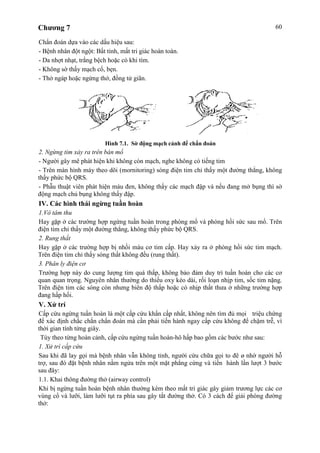 Chương 7 60
Chẩn đoán dựa vào các dấu hiệu sau:
- Bệnh nhân đột ngột: Bất tỉnh, mất tri giác hoàn toàn.
- Da nhợt nhạt, trắng bệch hoặc có khi tím.
- Không sờ thấy mạch cổ, bẹn.
- Thở ngáp hoặc ngừng thở, đồng tử giãn.
Hình 7.1. Sờ động mạch cảnh để chẩn đoán
2. Ngừng tim xảy ra trên bàn mổ
- Người gây mê phát hiện khi không còn mạch, nghe không có tiếng tim
- Trên màn hình máy theo dõi (mornitoring) sóng điện tim chỉ thấy một đường thẳng, không
thấy phức bộ QRS.
- Phẫu thuật viên phát hiện máu đen, không thấy các mạch đập và nếu đang mở bụng thì sờ
động mạch chủ bụng không thấy đập.
IV. Các hình thái ngừng tuần hoàn
1.Vô tâm thu
Hay gặp ở các trường hợp ngừng tuần hoàn trong phòng mổ và phòng hồi sức sau mổ. Trên
điện tim chỉ thấy một đường thẳng, không thấy phức bộ QRS.
2. Rung thất
Hay gặp ở các trường hợp bị nhồi máu cơ tim cấp. Hay xảy ra ở phòng hồi sức tim mạch.
Trên điện tim chỉ thấy sóng thất không đều (rung thất).
3. Phân ly điện cơ
Trường hợp này do cung lượng tim quá thấp, không bảo đảm duy trì tuần hoàn cho các cơ
quan quan trọng. Nguyên nhân thường do thiếu oxy kéo dài, rối loạn nhịp tim, sốc tim nặng.
Trên điện tim các sóng còn nhưng biên độ thấp hoặc có nhịp thất thưa ở những trường hợp
đang hấp hối.
V. Xử trí
Cấp cứu ngừng tuần hoàn là một cấp cứu khẩn cấp nhất, không nên tìm đủ mọi triệu chứng
để xác định chắc chắn chẩn đoán mà cần phải tiến hành ngay cấp cứu không để chậm trễ, vì
thời gian tính từng giây.
Tùy theo từng hoàn cảnh, cấp cứu ngừng tuần hoàn-hô hấp bao gồm các bước như sau:
1. Xử trí cấp cứu
Sau khi đã lay gọi mà bệnh nhân vẫn không tỉnh, người cứu chữa gọi to đê ø nhờ người hỗ
trợ, sau đó đặt bệnh nhân nằm ngửa trên một mặt phẳng cứng và tiến hành lần lượt 3 bước
sau đây:
1.1. Khai thông đường thở (airway control)
Khi bị ngừng tuần hoàn bệnh nhân thường kèm theo mất tri giác gây giảm trương lực các cơ
vùng cổ và lưỡi, làm lưỡi tụt ra phía sau gây tắt đường thở. Có 3 cách để giải phóng đường
thở:
 