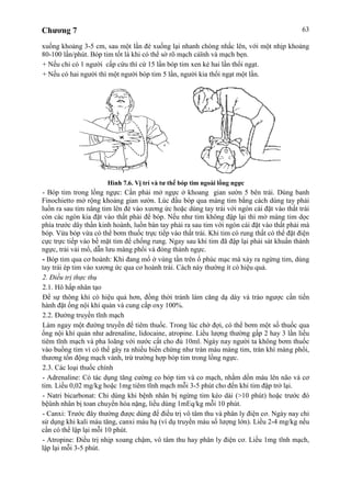 Chương 7 63
xuống khoảng 3-5 cm, sau một lần đè xuống lại nhanh chóng nhấc lên, với một nhịp khoảng
80-100 lần/phút. Bóp tim tốt là khi có thể sờ rõ mạch cảïnh và mạch bẹn.
+ Nếu chỉ có 1 người cấp cứu thì cứ 15 lần bóp tim xen kẻ hai lần thổi ngạt.
+ Nếu có hai người thì một người bóp tim 5 lần, người kia thổi ngạt một lần.
Hình 7.6. Vị trí và tư thế bóp tim ngoài lồng ngực
- Bóp tim trong lồng ngực: Cần phải mở ngực ở khoang gian sườn 5 bên trái. Dùng banh
Finochietto mở rộng khoảng gian sườn. Lúc đầu bóp qua màng tim bằng cách dùng tay phải
luồn ra sau tim nâng tim lên đè vào xương ức hoặc dùng tay trái với ngón cái đặt vào thất trái
còn các ngón kia đặt vào thất phải để bóp. Nếu như tim không đập lại thì mở màng tim dọc
phía trước dây thần kinh hoành, luồn bàn tay phải ra sau tim với ngón cái đặt vào thất phải mà
bóp. Vừa bóp vừa có thể bơm thuốc trực tiếp vào thất trái. Khi tim có rung thất có thể đặt điện
cực trực tiếp vào bề mặt tim để chống rung. Ngay sau khi tim đã đập lại phải sát khuẩn thành
ngực, trải vải mổ, dẫn lưu màng phổi và đóng thành ngực.
- Bóp tim qua cơ hoành: Khi đang mổ ở vùng tần trên ổ phúc mạc mà xảy ra ngừng tim, dùng
tay trái ép tim vào xương ức qua cơ hoành trái. Cách này thường ít có hiệu quả.
2. Điều trị thực thụ
2.1. Hô hấp nhân tạo
Để sự thông khí có hiệu quả hơn, đồng thời tránh làm căng dạ dày và trào ngược cần tiến
hành đặt ống nội khí quản và cung cấp oxy 100%.
2.2. Đường truyền tĩnh mạch
Làm ngay một đường truyền để tiêm thuốc. Trong lúc chờ đợi, có thể bơm một số thuốc qua
ống nội khí quản như adrenaline, lidocaine, atropine. Liều lượng thường gấp 2 hay 3 lần liều
tiêm tĩnh mạch và pha loãng với nước cất cho đủ 10ml. Ngày nay người ta không bơm thuốc
vào buồng tim vì có thể gây ra nhiều biến chứng như tràn máu màng tim, tràn khí màng phổi,
thương tổn động mạch vành, trừ trường hợp bóp tim trong lồng ngực.
2.3. Các loại thuốc chính
- Adrenaline: Có tác dụng tăng cường co bóp tim và co mạch, nhằm dồn máu lên não và cơ
tim. Liều 0,02 mg/kg hoặc 1mg tiêm tĩnh mạch mỗi 3-5 phút cho đến khi tim đập trở lại.
- Natri bicarbonat: Chỉ dùng khi bệnh nhân bị ngừng tim kéo dài (>10 phút) hoặc trước đó
bệûnh nhân bị toan chuyển hóa nặng, liều dùng 1mEq/kg mỗi 10 phút.
- Canxi: Trước đây thường được dùng để điều trị vô tâm thu và phân ly điện cơ. Ngày nay chỉ
sử dụng khi kali máu tăng, canxi máu hạ (ví dụ truyền máu số lượng lớn). Liều 2-4 mg/kg nếu
cần có thể lập lại mỗi 10 phút.
- Atropine: Điều trị nhịp xoang chậm, vô tâm thu hay phân ly điện cơ. Liều 1mg tĩnh mạch,
lập lại mỗi 3-5 phút.
 