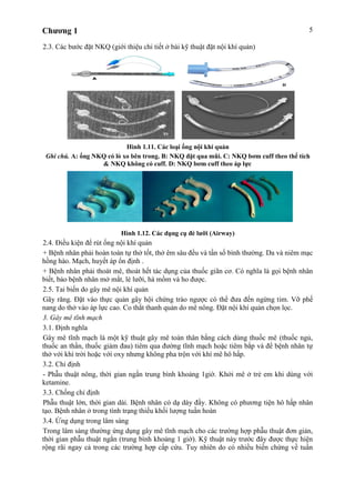 Chương 1 5
2.3. Các bước đặt NKQ (giới thiệu chi tiết ở bài kỹ thuật đặt nội khí quản)
Hình 1.11. Các loại ống nội khí quản
Ghi chú. A: ống NKQ có lò xo bên trong. B: NKQ đặt qua mũi. C: NKQ bơm cuff theo thể tích
& NKQ không có cuff. D: NKQ bơm cuff theo áp lực
Hình 1.12. Các dụng cụ đè lưỡi (Airway)
2.4. Điều kiện để rút ống nội khí quản
+ Bệnh nhân phải hoàn toàn tự thở tốt, thở êm sâu đều và tần số bình thường. Da và niêm mạc
hồng hào. Mạch, huyết áp ổn định .
+ Bệnh nhân phải thoát mê, thoát hết tác dụng của thuốc giãn cơ. Có nghĩa là gọi bệnh nhân
biết, bảo bệnh nhân mở mắt, lè lưỡi, há mồm và ho được.
2.5. Tai biến do gây mê nội khí quản
Gãy răng. Đặt vào thực quản gây hội chứng trào ngược có thể đưa đến ngừng tim. Vỡ phế
nang do thở vào áp lực cao. Co thắt thanh quản do mê nông. Đặt nội khí quản chọn lọc.
3. Gây mê tĩnh mạch
3.1. Định nghĩa
Gây mê tĩnh mạch là một kỹ thuật gây mê toàn thân bằng cách dùng thuốc mê (thuốc ngủ,
thuốc an thần, thuốc giảm đau) tiêm qua đường tĩnh mạch hoặc tiêm bắp và để bệnh nhân tự
thở với khí trời hoặc với oxy nhưng không pha trộn với khí mê hô hấp.
3.2. Chỉ định
- Phẫu thuật nông, thời gian ngắn trung bình khoảng 1giờ. Khởi mê ở trẻ em khi dùng với
ketamine.
3.3. Chống chỉ định
Phẫu thuật lớn, thời gian dài. Bệnh nhân có dạ dày đầy. Không có phương tiện hô hấp nhân
tạo. Bệnh nhân ở trong tình trạng thiếu khối lượng tuần hoàn
3.4. Ứng dụng trong lâm sàng
Trong lâm sàng thường ứng dụng gây mê tĩnh mạch cho các trường hợp phẫu thuật đơn giản,
thời gian phẫu thuật ngắn (trung bình khoảng 1 giờ). Kỹ thuật này trước đây được thực hiện
rộng rãi ngay cả trong các trường hợp cấp cứu. Tuy nhiên do có nhiều biến chứng về tuần
 