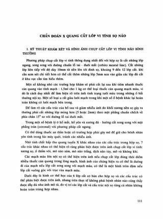 CHẨN ĐOÁN X QUANG CẮT LÓP VI TÍNH sọ NÁO
1. Kỹ THUẬT KHẢM XÉT VÀ HÌNH ẢNH CHỤP CẮT LỚP VI TÍNH NÁO BÌNH
THƯỜNG
Phương pháp chụp cắt lóp vi tính thông dụng nhất dối vối hộp sọ là cắt những lớp
ngang, song song vói đường chuẩn lỗ tai - đuôi mắt (orbito meatal line). cắt nhũng
lóp liên tiếp vói độ dày lOmm tù nền lên tối đình sọ, khoảng 9 đến 12 lớp cắt. khi
càn xem xét chi tiết hon có thế cắt thêm những lóp 5mm xen vào giũa các lốp dã cắt
ã khu vực cần tìm hiểu thêm.
Một số không nhỏ các truồng họp khám sẽ phải cắt lại sau khi tiêm nhanh thuốc
cản quang vào tĩnh mạch : l,5ml cho Ì kg co thể loại thuốc cản quang mạch máu, vì
đó là cách duy nhất đề làm hiện rỗ trên ảnh tình trạng tuói máu trong nhữngổ bất
thuồng nội sọ. Một số loại u rất giàu lưới mạch trong khi một sốổ bệnh khác lại hoàn
toàn không có lưới mạch bên trong.
Đế làm rõ các cấu trúc của hố sau và giảm nhiễu ảnh do khối xương nền sọ gây ra
thuồng phải cắt nhũng lóp mỏng hon (5 hoặc 2mm) theo mặt phăng chuẩn chếch về
phía chân 15° so vói đường lỗ tai đuôi mắt.
Trong một số bệnh lý ỏ hố mắt, hố yên và xương đá - huống cắt song song vói mặt
phang trán (coronal) vói phương pháp cắt ngang.
Có thế dùng thuốc an thần hoặc có trường họp phải gây mê đề giũ cho bênh nhân
yên tĩnh trong lúc máy quét, tránh các nhiễu ảnh.
Nhò tính chất hấp thu quang tuyến X khác nhau cùa các cấu trúc trong hộp sọ, 7
cấu trúc khác nhau có thể hiện rõ ràng phân biệt được trên ảnh chụp cắt lớp vi tính:
xương sọ,ổ thấm vôi, mô não xám, mô não trắng, dịch náo tùy, mồ và không khí.
Các mạch máu lòn nội sọ có thể hiện trên ảnh nếu chụp cắt lóp đúng thòi điếm
nhiều thuốc cản quang trong lòng mạch, hình ảnh của chúng hiện ra có thể là đuòng
di của mạch nếu lóp cắt song song vói mạch máu, có thế là một hình tròn đậm nếu
lóp cắt vuông góc vói trục của mạch máu.
Đuôi đây là hình co thể học của 6 lóp cắt co bản cho hộp sọ và các cấu trúc có
thề phân biệt được trên ảnh, nhung trên thục tế không phải bệnh nhân nào cũng thấy
duọc dầy đủ nhu ảnh mô tả, do vị trí các lóp cắt và cấu trúc nội sọ từng cá nhân không
hoàn toàn trùng họp nhau.
IU
 